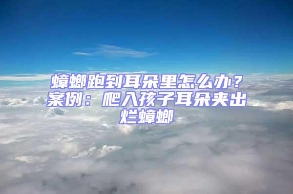 蟑螂跑到耳朵里怎么辦?案例:爬入孩子耳朵夾出爛蟑螂