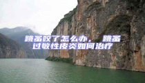 跳蚤咬了怎么辦, 跳蚤過(guò)敏性皮炎如何治療