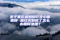 女子景區(qū)被螞蟻叮咬心臟驟停 被紅火蟻咬了怎么辦如何處理？